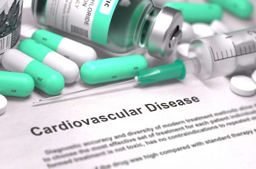 Cardiovascular-Disease Cardiovascular Disease