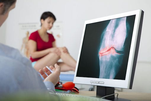 Osteoarthritis